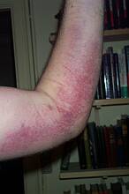 Tirsdag den 5. kl. 9:00