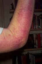 Torsdag den 7. kl. 18:20